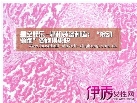 星空娱乐-煤机装备制造:“被动领跑”要跑得更快(图1) 星空娱乐